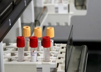 Δωρεάν εξετάσεις για τις ευπαθείς ομάδες