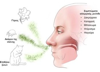 Αλλεργική ρινίτιδα: Διάγνωση και αντιμετώπιση