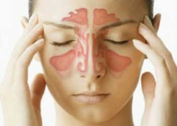 Ιγμορίτιδα