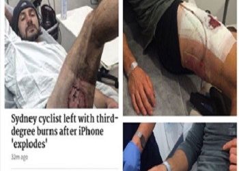 Ποδηλάτης υπέστη σοβαρό έγκαυμα από το iPhone του