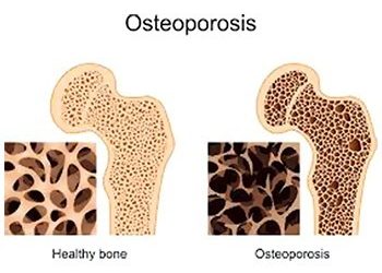 Η δημόσια υγεία προτεραιότητα του Δήμου