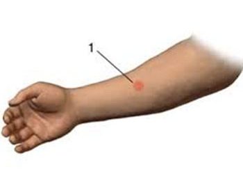 Διενέργεια δερμοαντίδρασης Μantoux στα νηπιαγωγεία