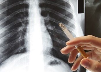 Εξετάστηκαν δωρεάν 30 καπνιστές με σπιρομέτρηση