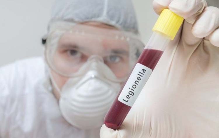 Έλεγχοι από την Περιφέρεια Αττικής για τη «νόσο των λεγεωνάριων»