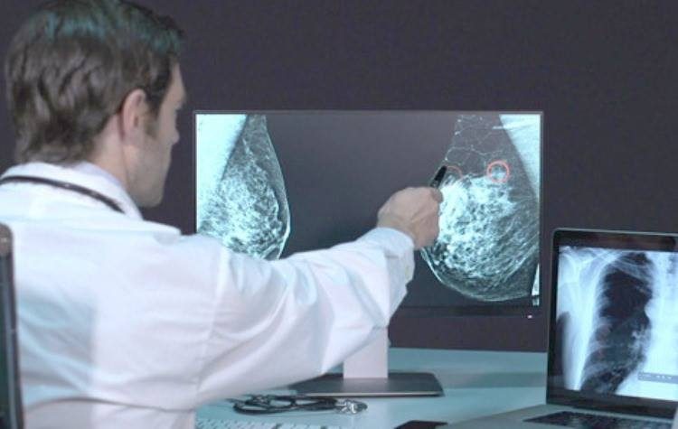 Δωρεάν μαστογραφίες από τον δήμο και συζήτηση για την πρόληψη