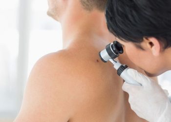 Δωρεάν έλεγχος σπίλων από το ΚΕΠ Υγείας Δήμου Κηφισιάς