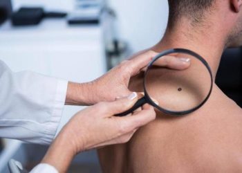 Δωρεάν έλεγχο σπίλων πραγματοποίησε το ΚΕΠ Υγείας