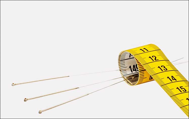 Παχυσαρκία: Πώς μπορεί ο βελονισμός να βοηθήσει