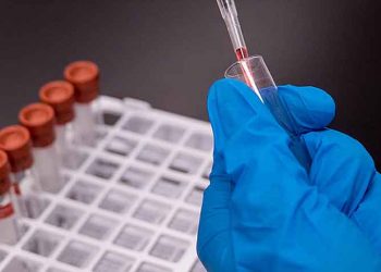 Κορωνοϊός: 2506 τα επιβεβαιωμένα κρούσματα στη χώρα - 130 νεκροί