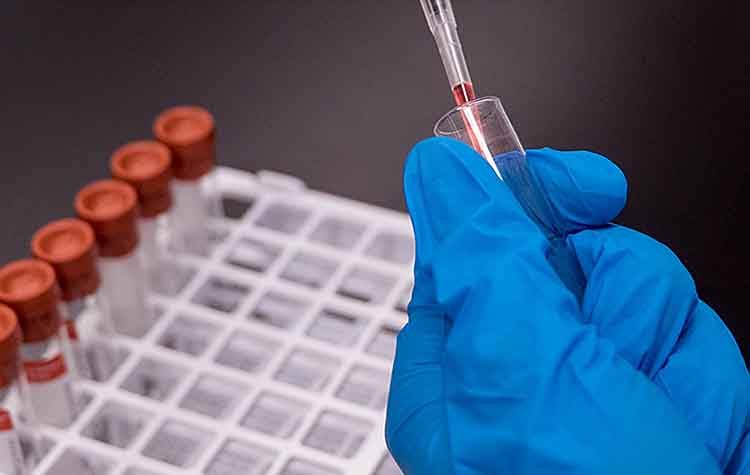 Κορωνοϊός: 2506 τα επιβεβαιωμένα κρούσματα στη χώρα - 130 νεκροί