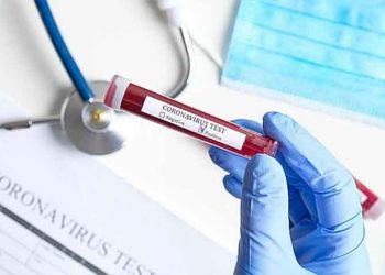 Η καμπύλη της πανδημίας του κορωνοΐού στην Ελλάδα - Γραφήματα