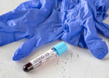 Δέσμη προτάσεων από την αντιπολίτευση για την αντιμετώπιση της πανδημίας