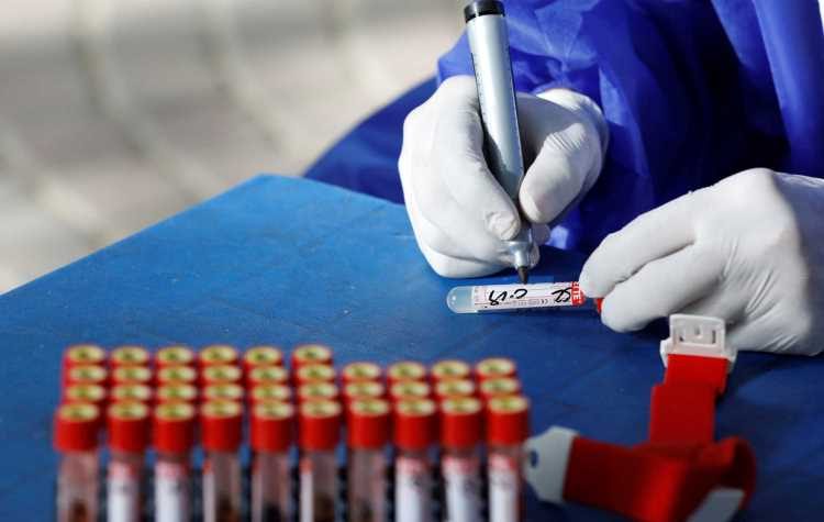 Σύλλογος Τσακού: «Χρειάζονται rapid test για να περιοριστεί η πανδημία»