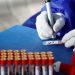Σύλλογος Τσακού: «Χρειάζονται rapid test για να περιοριστεί η πανδημία»