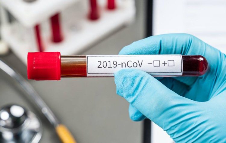 Παραλαβή rapid test και σύμβαση με διαγνωστικό κέντρο στη Νέα Σμύρνη
