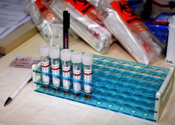 Κορωνοϊός: 509 νέα κρούσματα - 293 διασωληνωμένοι - 25 θάνατοι