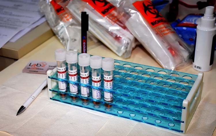 Κορωνοϊός: 509 νέα κρούσματα - 293 διασωληνωμένοι - 25 θάνατοι