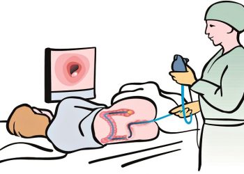 Η αξία της κολονοσκόπησης ως προληπτικής εξέτασης