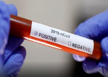 Κρούσμα κορωνοϊού στην Τεχνική Υπηρεσία του Δήμου