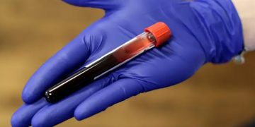 64η εθελοντική αιμοδοσία στις 6 Ιουνίου