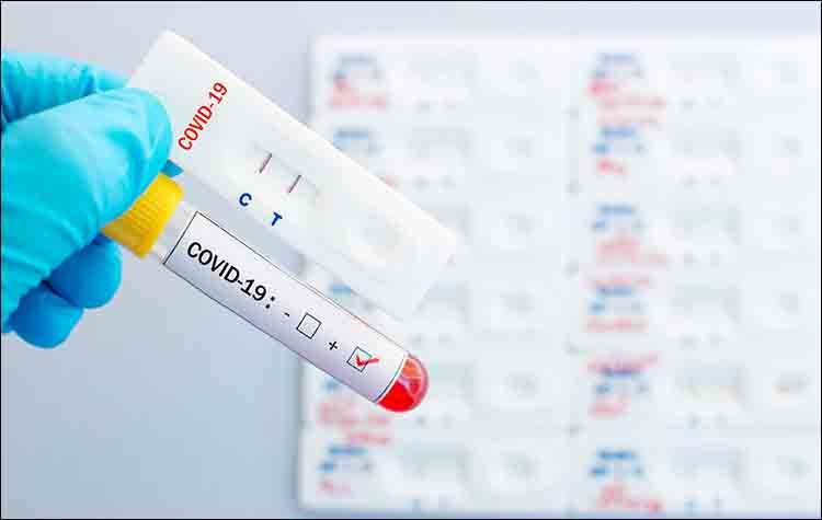 Δωρεάν rapid test στις επιχειρήσεις του Δήμου από το Ε.Ε.Α.