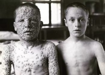 Η ευλογιά και η ευλογία