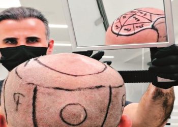 Τριχόπτωση και στιγματισμός: Υπάρχει λύση;