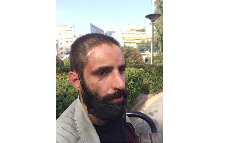 Eπίθεση από ομάδα φασιστών δέχτηκε ο Ορέστης Ηλίας