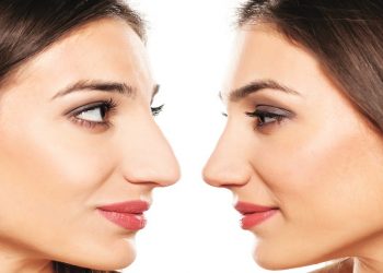 Ρινοπλαστική: Ποια προβλήµατα µπορεί να επιλύσει