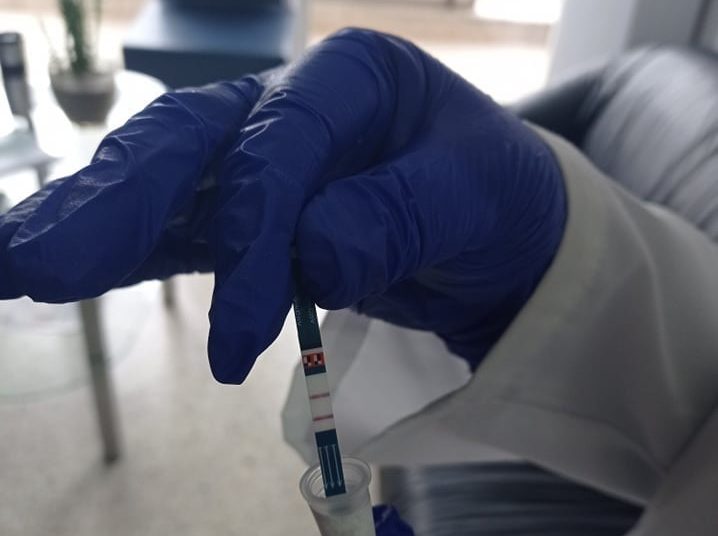 Τα αποτελέσματα των rapid test στα Δημοτικά Ιατρεία