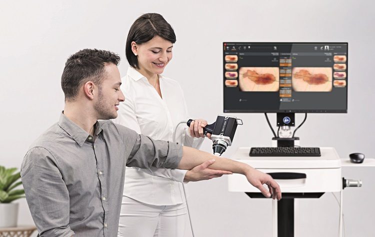 Η σημασία της δερματοσκόπησης στην πρόληψη του καρκίνου του δέρματος