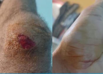 «Χαλάνδρι Ενάντια»: «Αποτρόπαια επίθεση φασιστοειδών σε μετανάστη εργάτη»