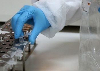 ΕΟΔΥ: 50 συνολικά τα κρούσματα ευλογιάς των πιθήκων στην Ελλάδα