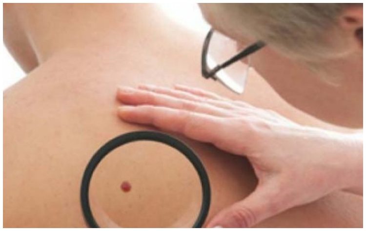 Δωρεάν προληπτικός δερματολογικός έλεγχος στα Δημοτικά Ιατρεία