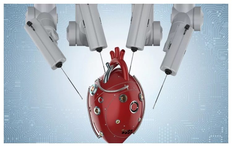 Θωρακοσκοπικό Bypass χωρίς στερνοτομή