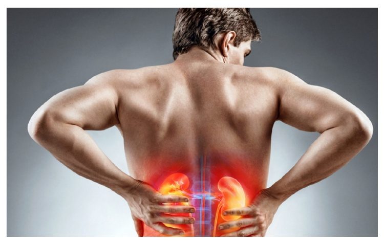 Λιθίαση νεφρού: Οριστική λύση με Laser σε συνδυασμό με ψηφιακή μικροκάμερα & συσκευή αναρρόφησης θραυσμάτων