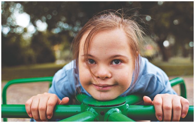 21 Μαρτίου: Παγκόσμια Ημέρα Σύνδρομου Down