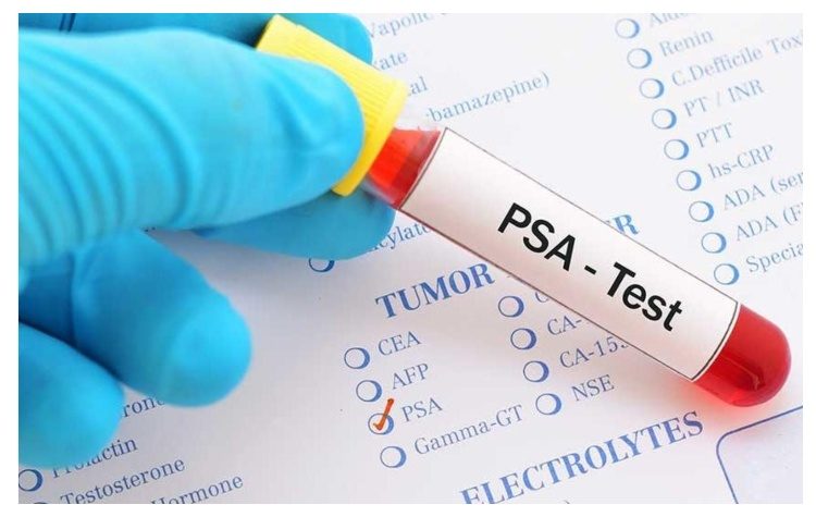 Δωρεάν προληπτικές εξετάσεις αίματος PSA για άνδρες 40–60 ετών στα Δημοτικά Ιατρεία