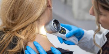 Θερμή ανταπόκριση στη διήμερη δράση πρόληψης για τον καρκίνο του δέρματος στο δημαρχείο Αμαρουσίου
