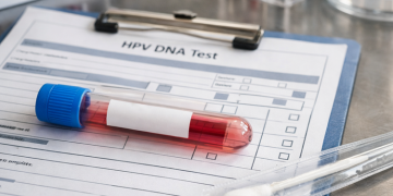 Ν. Φιλαδέλφεια – Ν. Χαλκηδόνα: Δωρεάν Test Παπ & HPV DNA Test για τις γυναίκες του Δήμου