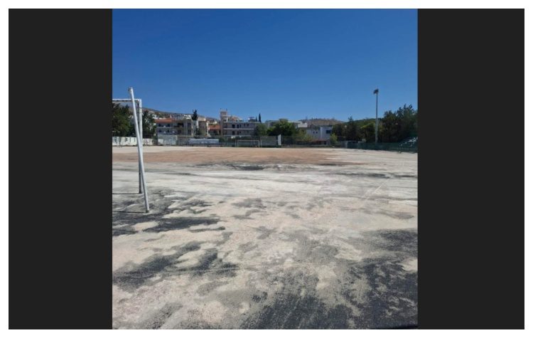 Συνεχίζονται οι εργασίες αναβάθμισης στο γήπεδο «Κυριάκος Τσιμπρικίδης» στα Μελίσσια, στο πλαίσιο του προγραμματισμού του Δήμου Πεντέλης για τη βελτίωση των αθλητικών υποδομών και τη δημιουργία σύγχρονων, ασφαλών και λειτουργικών χώρων για τους δημότες, όπως επισημαίνει η δημοτική Αρχή